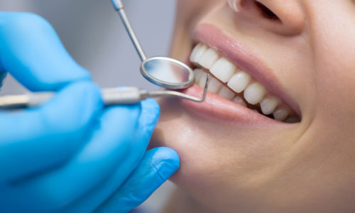 Dental cover for adults
